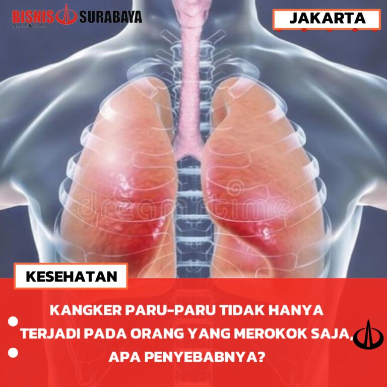 KANGKER PARU-PARU TIDAK HANYA TERJADI PADA ORANG YANG MEROKOK, APA PENYEBABNYA?